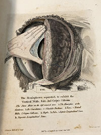 heart dissection